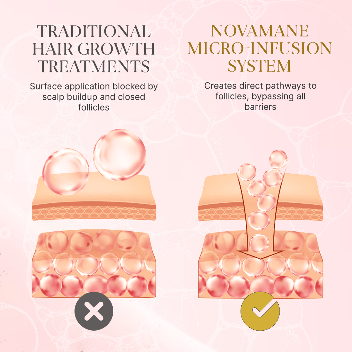 NovaMane™ Hair Regrowth 2.0