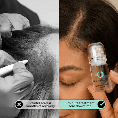 NovaMane™ Hair Regrowth 2.0
