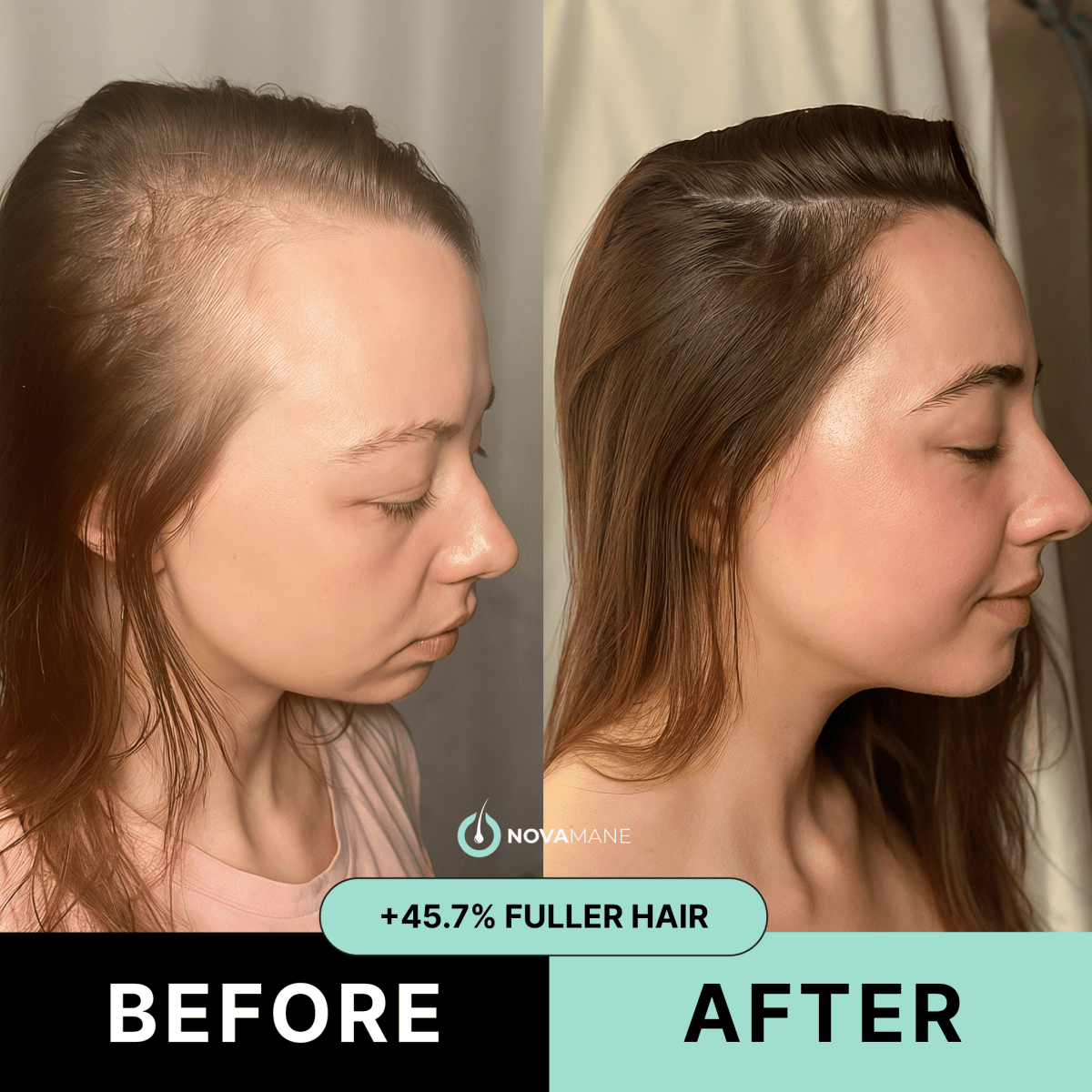 NovaMane™ Hair Regrowth 2.0
