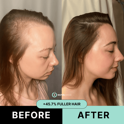 NovaMane™ Hair Regrowth 2.0