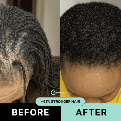 NovaMane™ Hair Regrowth 2.0