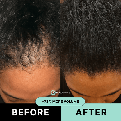 NovaMane™ Hair Regrowth 2.0